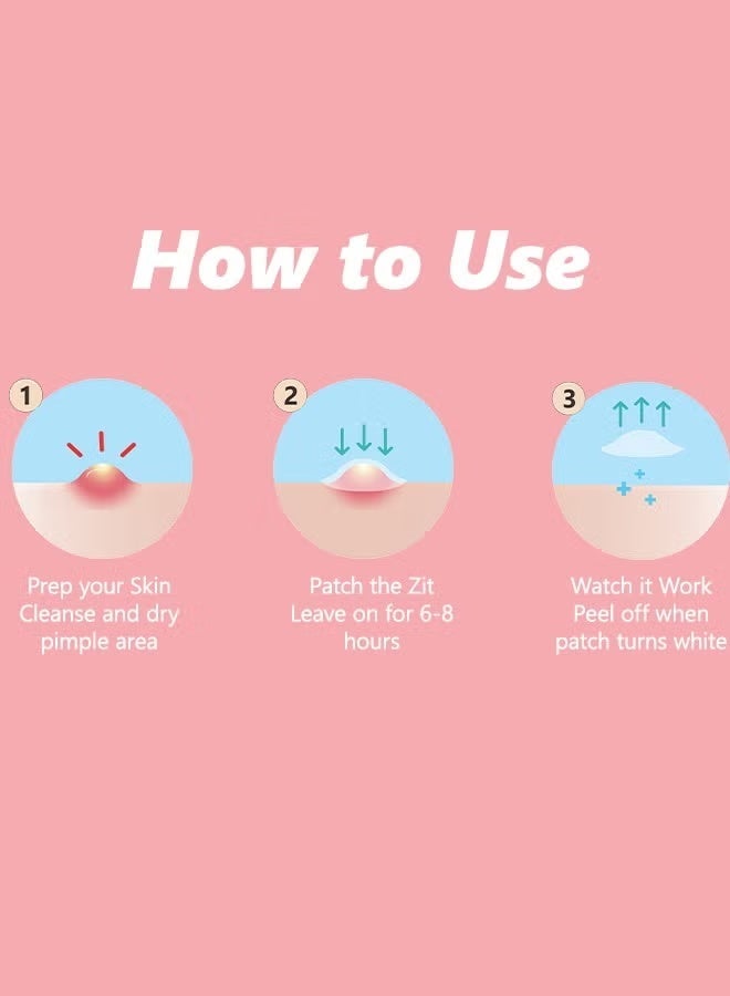 Floren Amazing Acne Patches | 30 Patches, 2 Sizes (10mm, 15 Patches, 12mm) | Invisible Daytime Acne Coverage | Hydrocolloid Acne Patches | For Treating Pimples, Spots, and Rashes | South Korean Skincare | Drug-Free, Gentle on Skin, and Cruelty-Free - Image 5